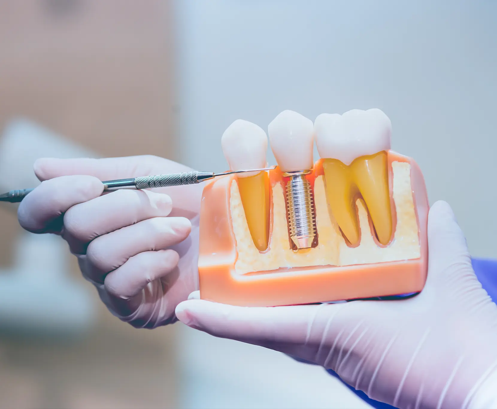 Yanmu Digital Client Laguna Premier Dental Photo 9